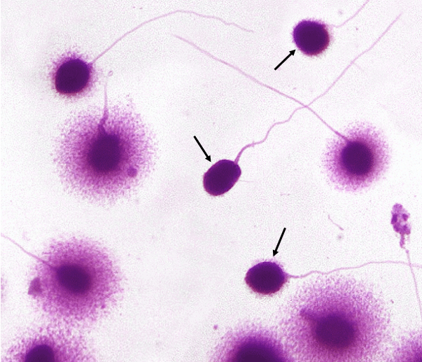 DNA Fragmentation